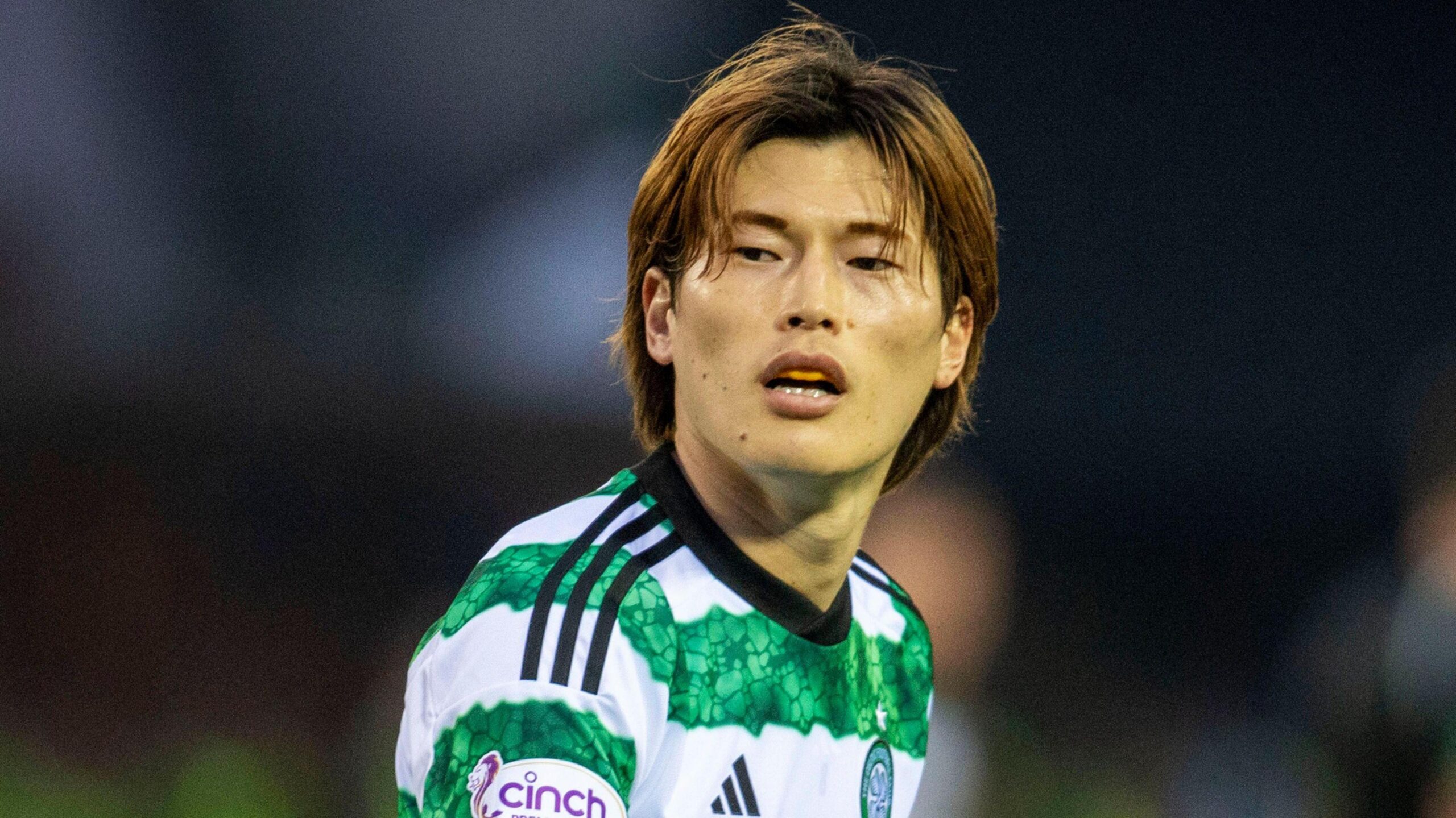 JUST IN: Impossible! Why would you Just Do Like That? Celtic Manager Declarer To Kyogo Furuhashi For…